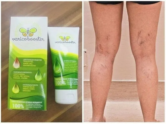 Wintex ultra gel